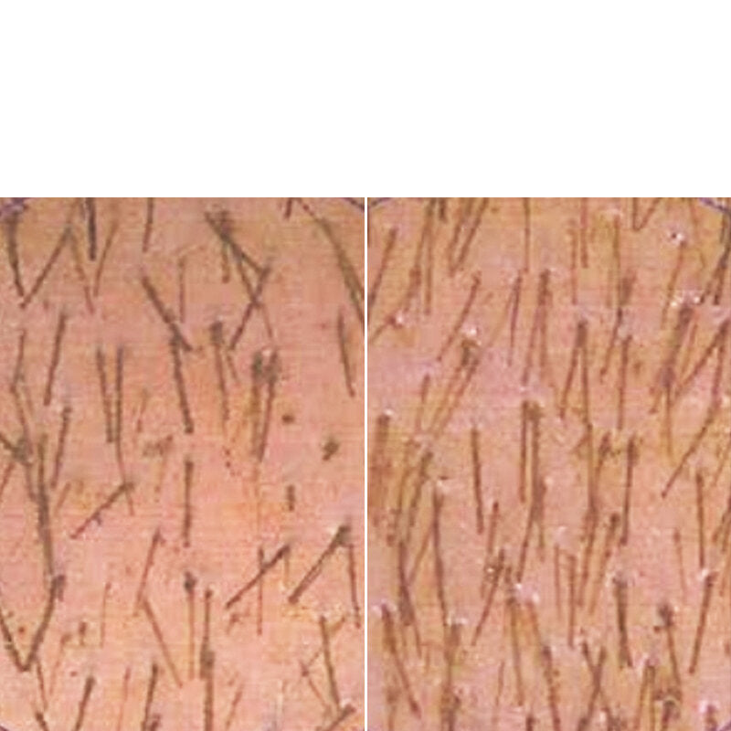 Hairlust reviews | Before & After photos
